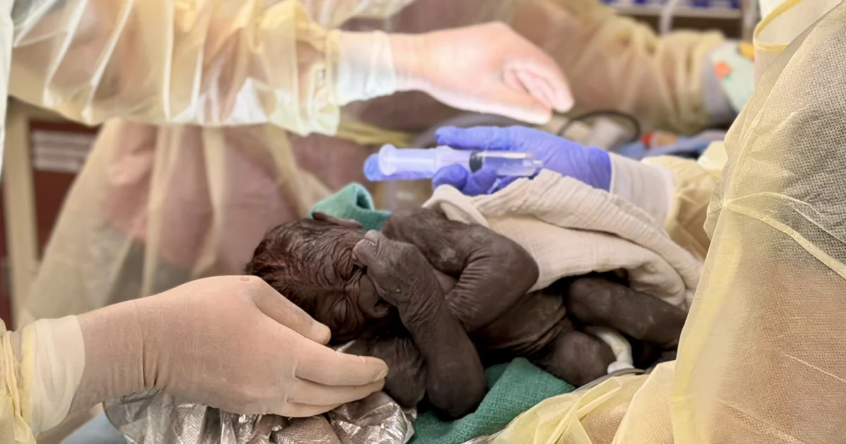Baby gorilla delivered via rare C-section at Seattle zoo