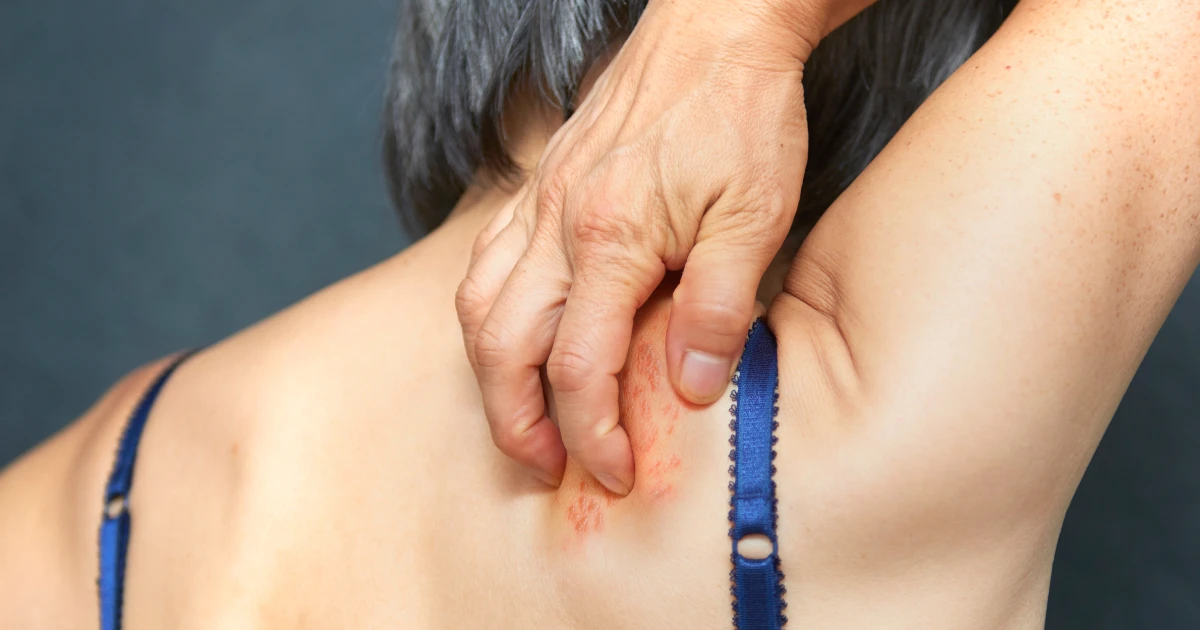 Shingles vaccine may also offer protection against dementia, studies increasingly show