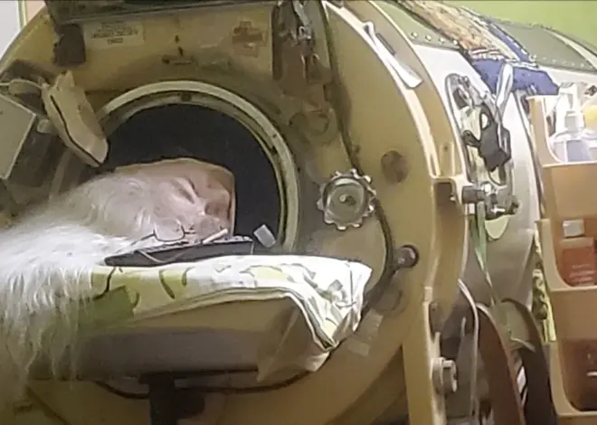 Last U.S. polio patient with an iron lung dies at 78 in Oklahoma