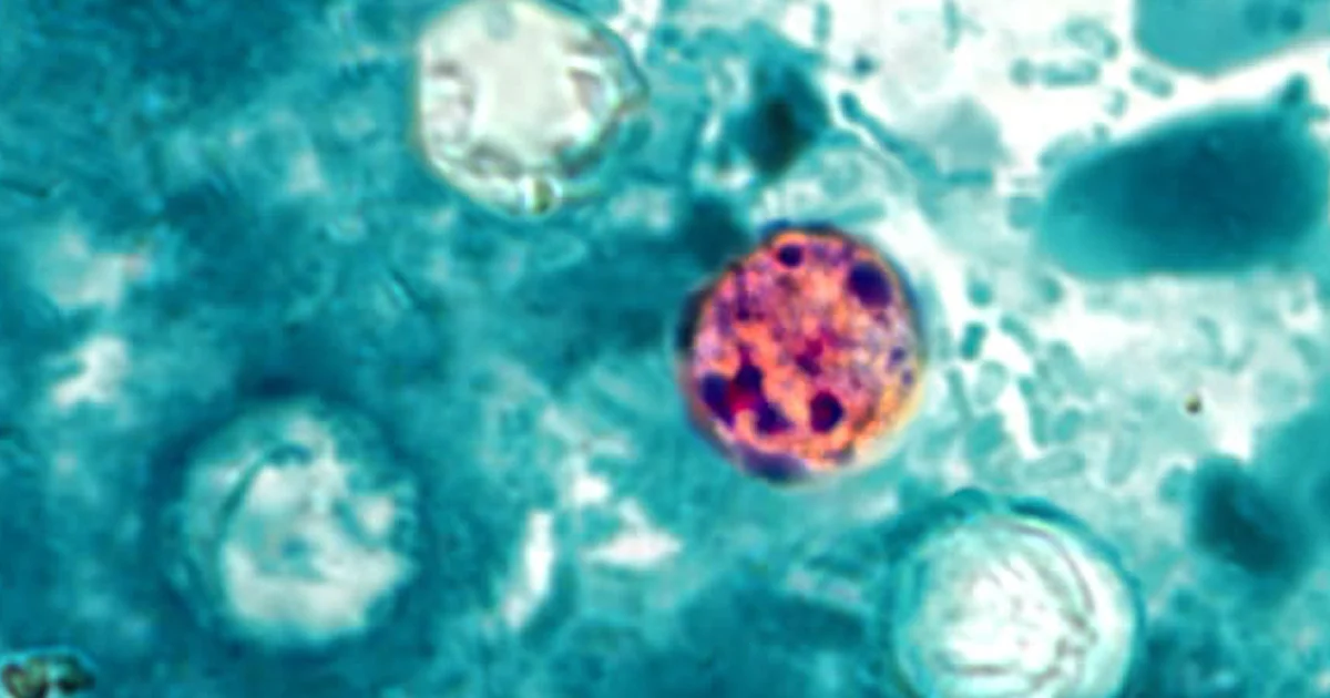 Nearly 7,000 cases of cyclosporiasis confirmed or under investigation nationwide, CDC says