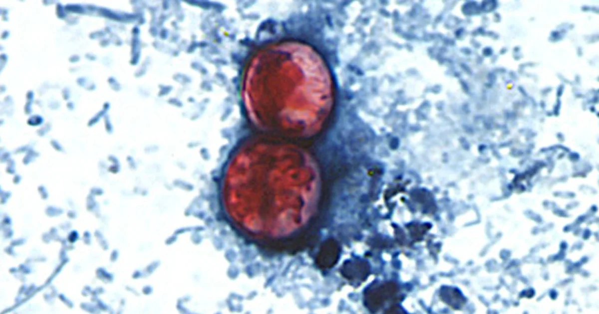 Lettuce may be tip of the iceberg as cyclosporiasis spreads