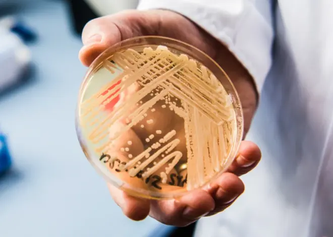 Deadly drug-resistant fungal infections rising in the U.S.