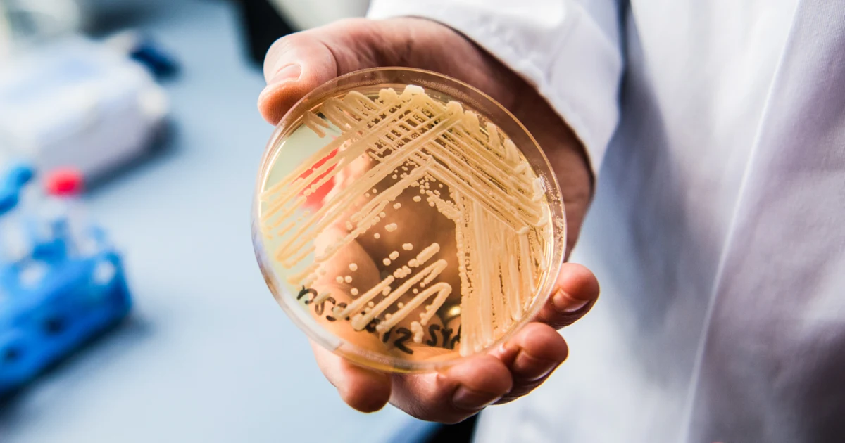 Deadly drug-resistant fungal infections rising in the U.S.