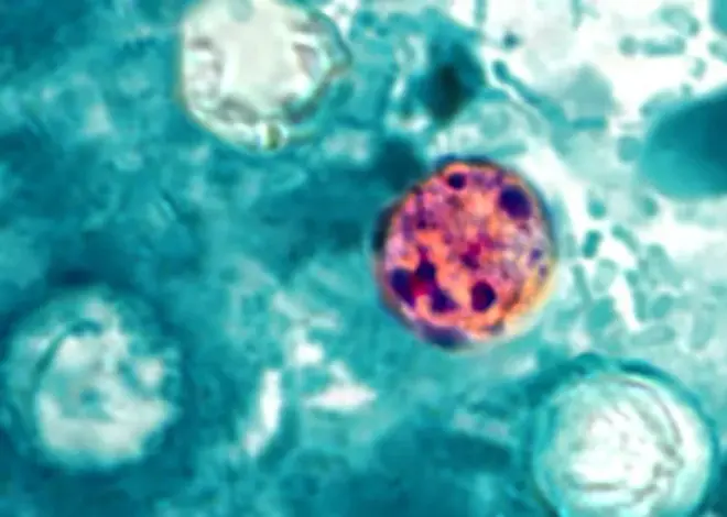 Lettuce or salad greens could be source of diarrhea-causing illness, Michigan health officials say