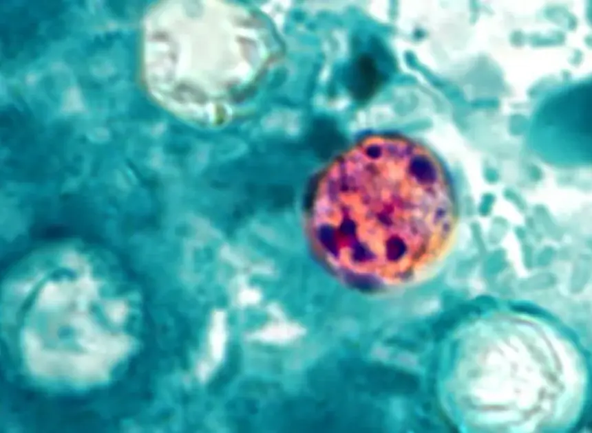 Lettuce or salad greens could be source of diarrhea-causing illness, Michigan health officials say