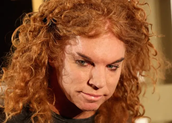 Comedian Carrot Top hospitalized and recovering, representative says
