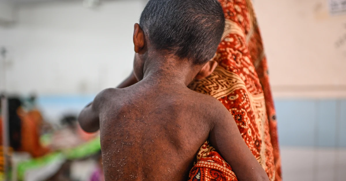 Suspected measles cases kill nearly 1,000 as Bangladesh struggles to contain outbreak