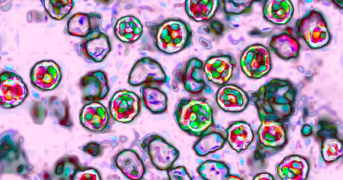Pennsylvania’s measles outbreak is the country’s largest in three decades